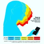 Illustration einer Frau, die auf ein Smartphone blickt, mit farbigen Silhouetten, die verschiedene Kopfneigungen darstellen. Je stärker die Neigung, desto höher die Belastung auf die Halswirbelsäule – von 5.4 kg (0°) bis 27.2 kg (60°). Rechts steht: „Pain in the neck – How the weight on your spine changes as you tilt your head“.