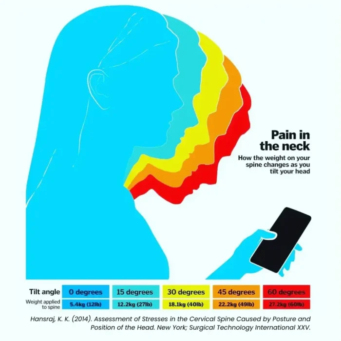 Illustration einer Frau, die auf ein Smartphone blickt, mit farbigen Silhouetten, die verschiedene Kopfneigungen darstellen. Je stärker die Neigung, desto höher die Belastung auf die Halswirbelsäule – von 5.4 kg (0°) bis 27.2 kg (60°). Rechts steht: „Pain in the neck – How the weight on your spine changes as you tilt your head“.